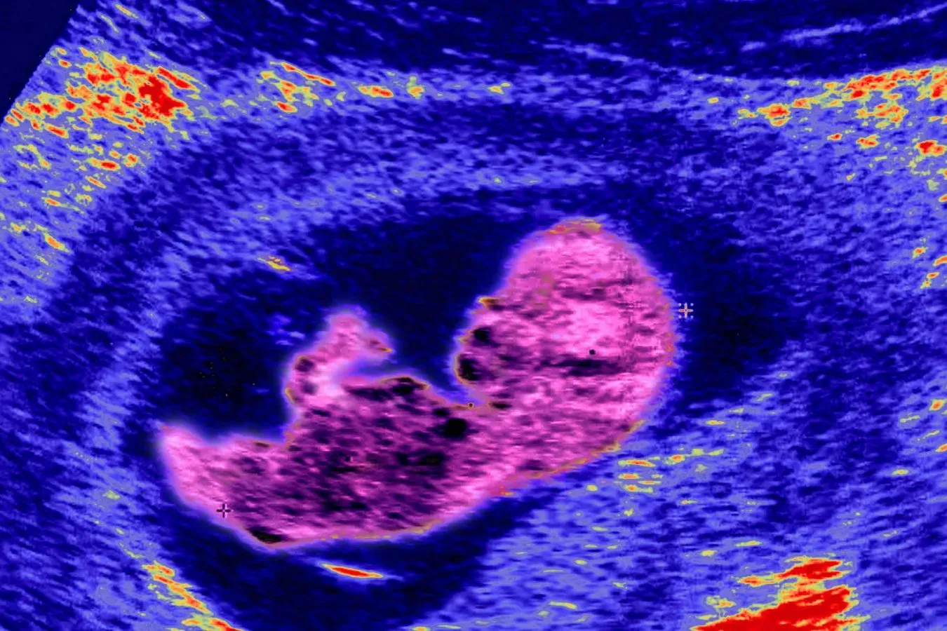 Cells from your mother could stay in your brain your whole life