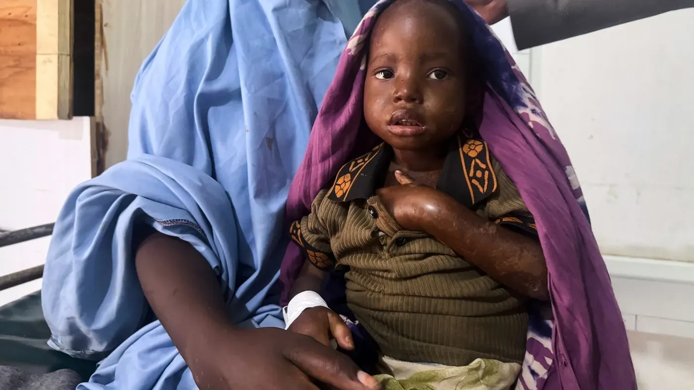 Mother's 3-day walk with sick daughter highlights Somalia's child malnutrition emergency