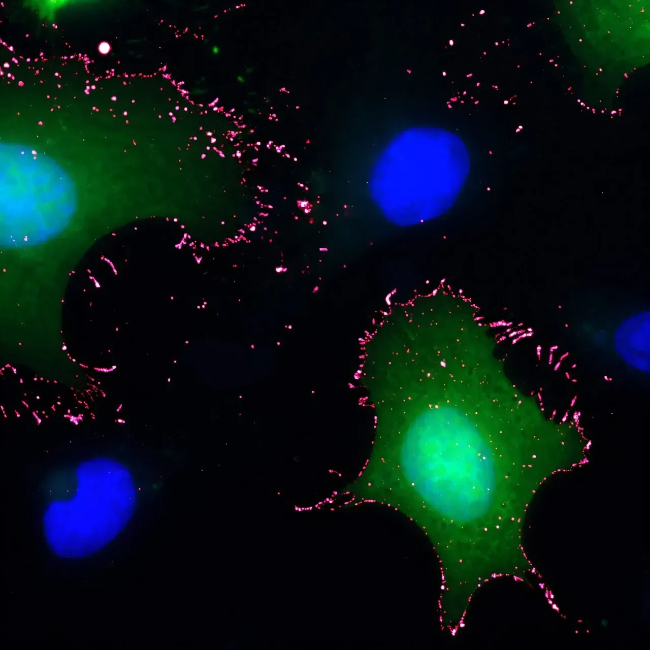 Scientists reveal how deadly Andes hantavirus attaches to human cells