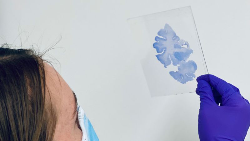 80-year-old ‘SuperAger’ brain operates like that of a 50-year-old. Here’s why