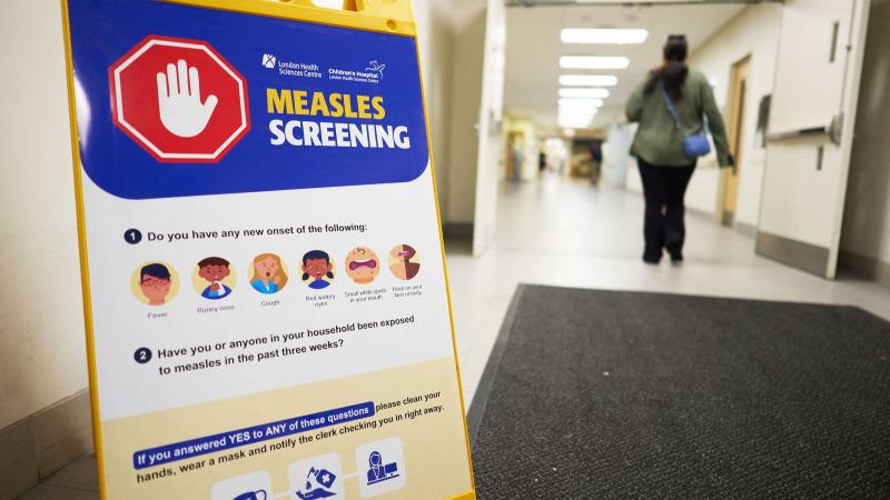 Canada is poised to lose its measles elimination status — and the US could, too