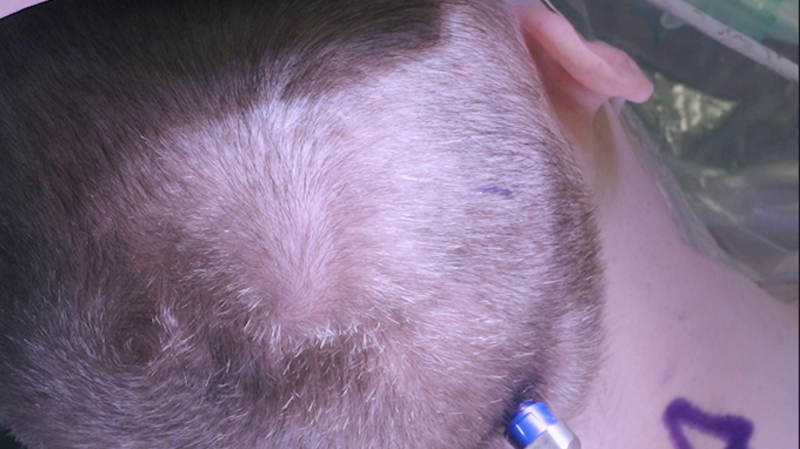 28-year-old man donates part of his brain for research