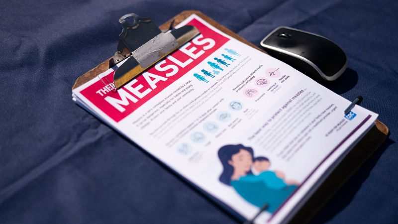 Newer testing methods suggest significant silent spread of measles in the US, threatening elimination