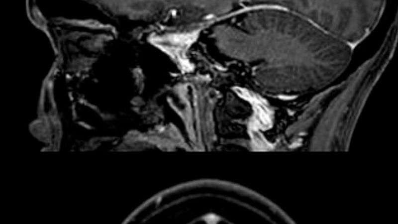 This News Anchor Was Diagnosed With Brain Cancer