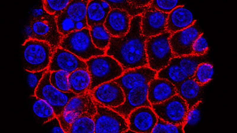 Experimental pill promises new hope for deadly pancreatic cancer