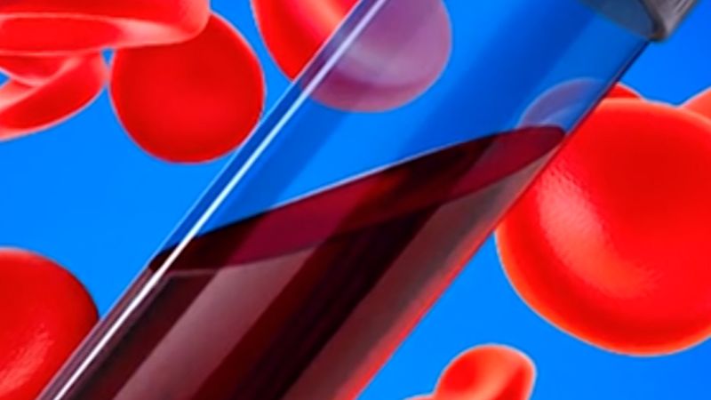 New option for diagnosing a cancer that’s on the rise in young people