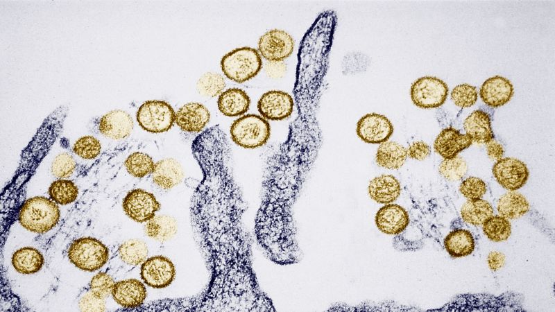 What do you want to know about hantavirus?