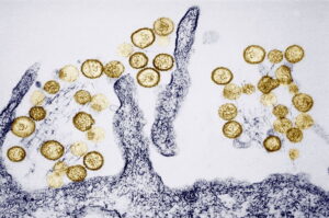 What is hantavirus and how does it spread? – KION Central Coast