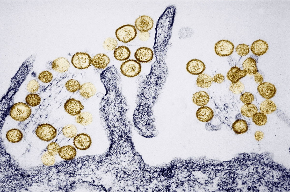 <i>AFP/Getty Images via CNN Newsource</i><br/>One hantavirus case has been confirmed on MV Hondius