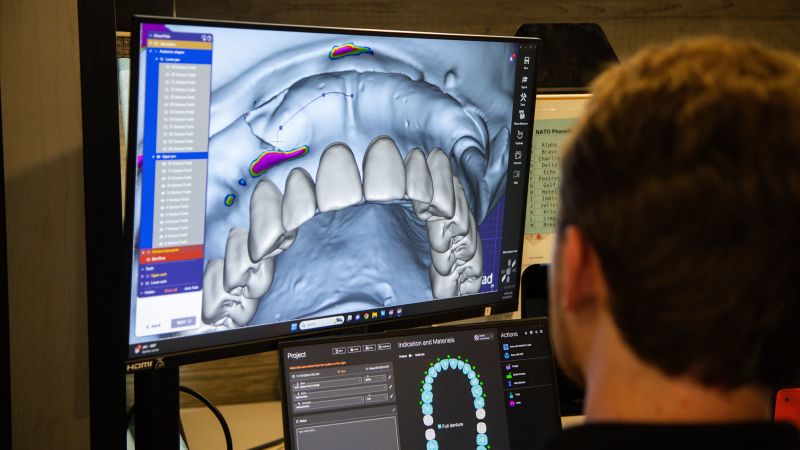 A 22-year-old engineer 3D prints dentures for low-income Americans