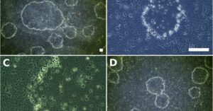A microorganism found on the Costa Brava expands the tree of evolution