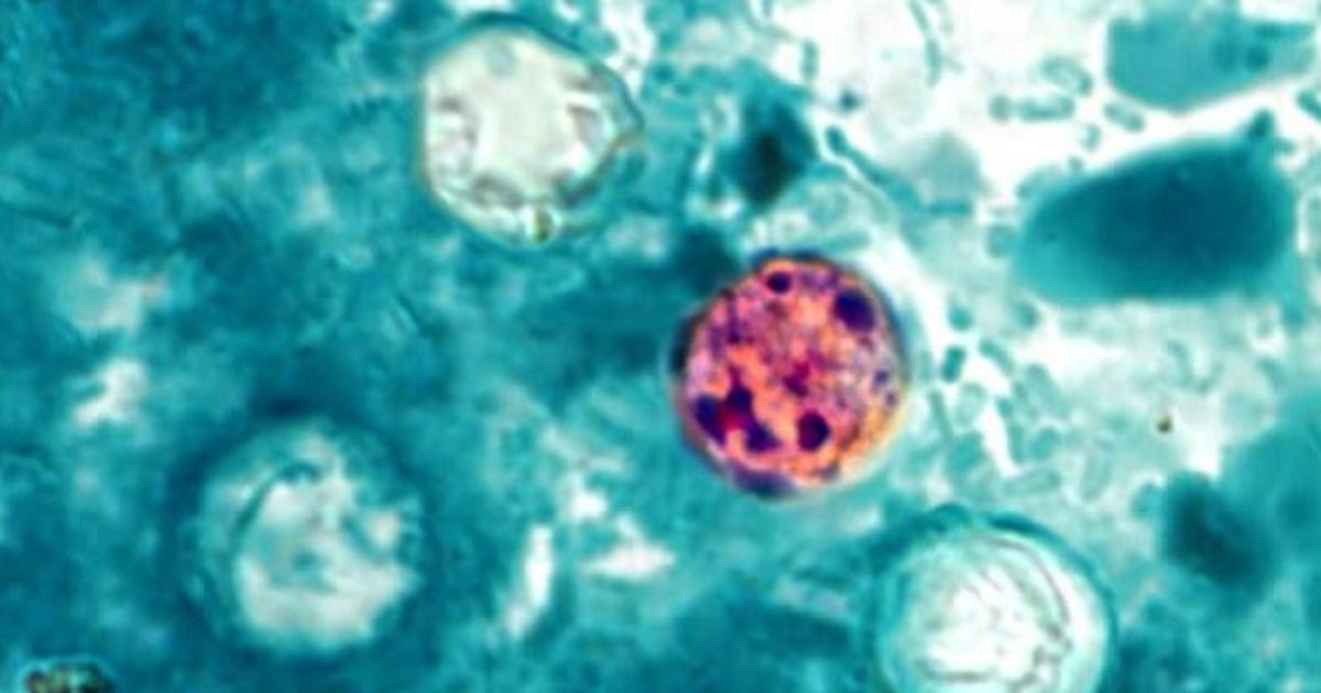 Cyclosporiasis outbreak has affected about 1 in every 1,000 people in Michigan