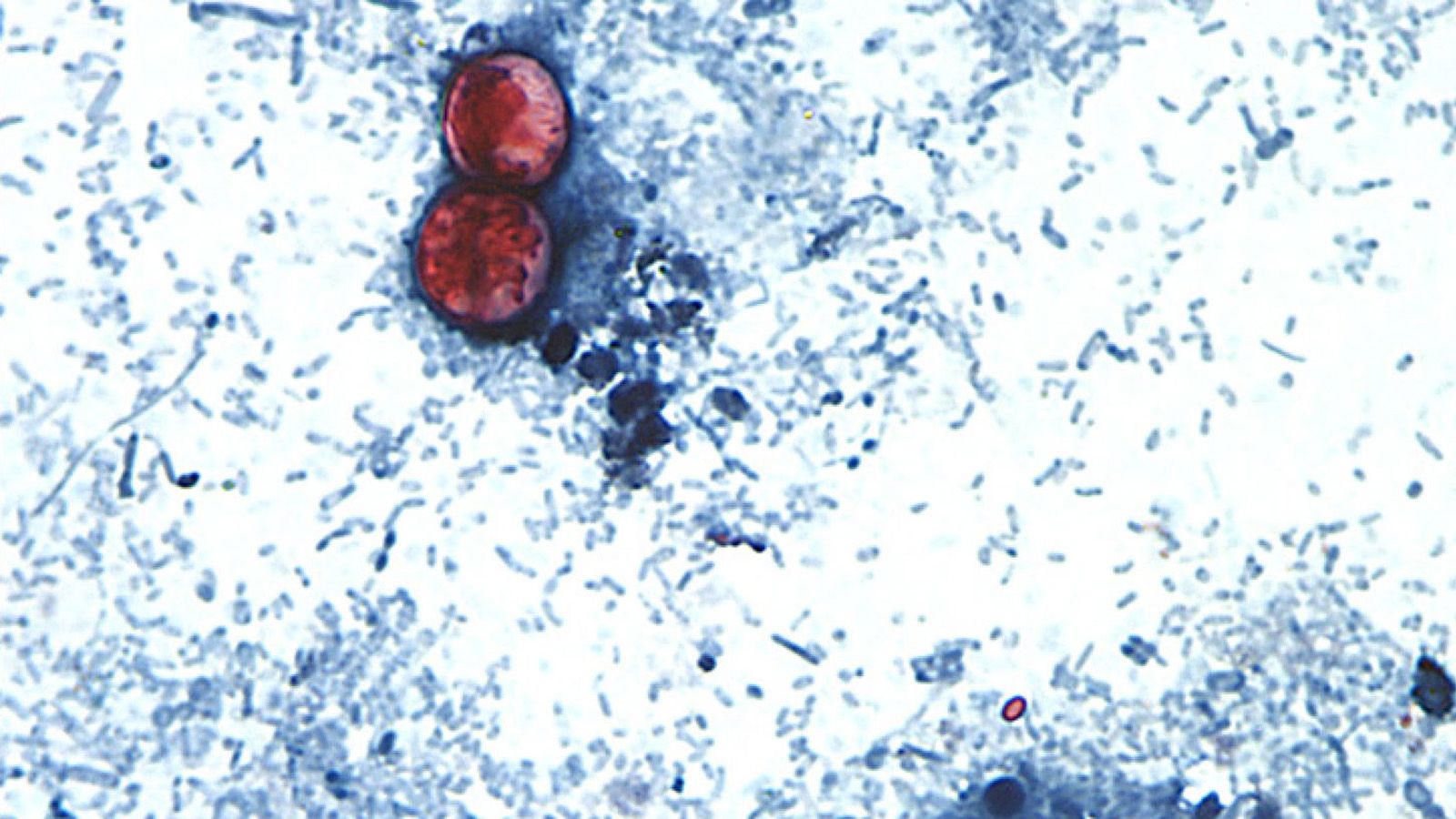 Cyclosporiasis outbreak has affected about 1 in every 1,000 people in Michigan - KQ2