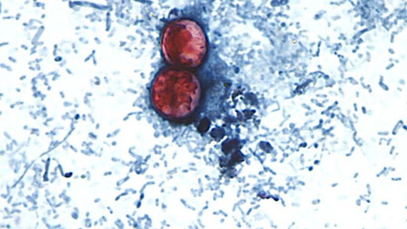 Diarrhea-causing parasite that can contaminate raw produce causing misery across several states