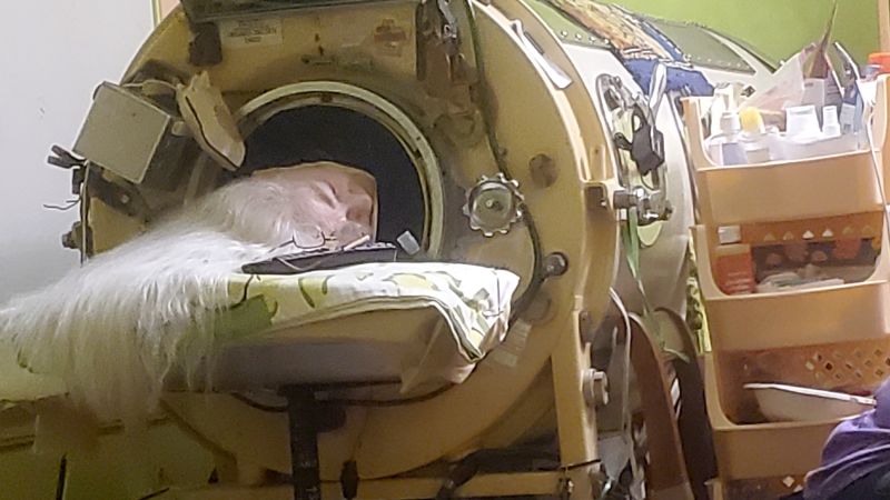 Martha Lillard, last US polio patient using iron lung, dies at 78 in Oklahoma